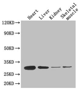 Polyclonal Rabbit anti-Human Adiponectin Antibody (WB)