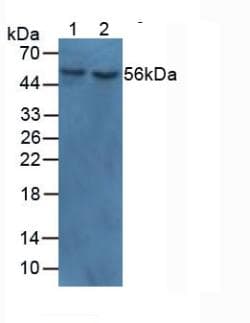 MYOC / Myocilin Antibody (aa224-471)