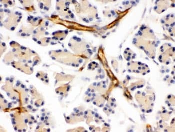 Polyclonal Rabbit anti-Human PPP1R1B / DARPP-32 Antibody (IHC, WB)