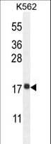 RPL27A Antibody (aa110-138)