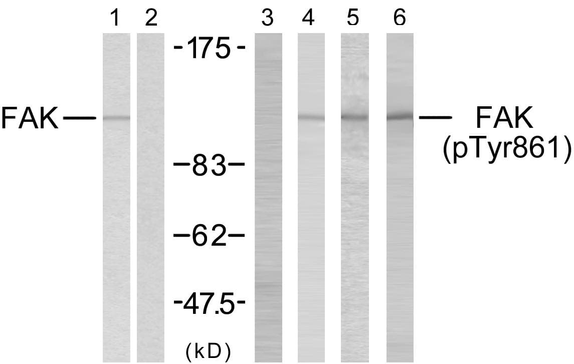 Polyclonal Rabbit anti-Human FAK / Focal Adhesion Kinase Antibody (p861, WB)