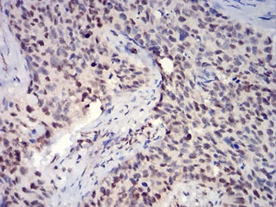 Monoclonal Mouse anti-Human HIST2H3C Antibody (clone 6E7A9, IHC, WB)