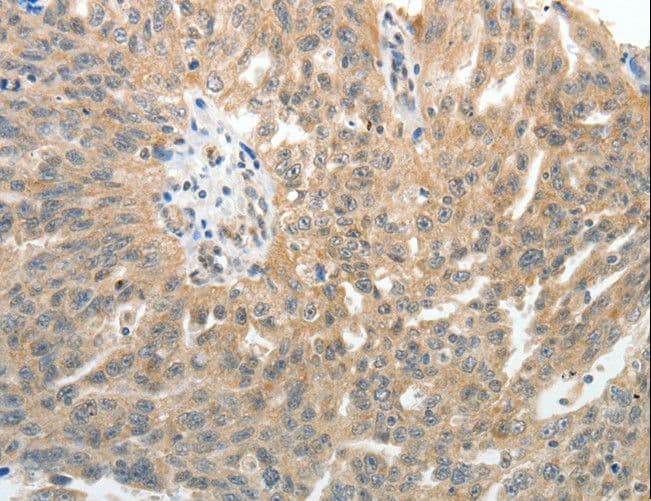 SELE / CD62E / E-selectin Antibody