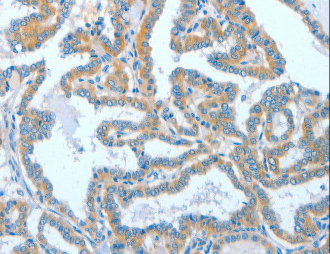 Polyclonal Rabbit anti-Human ASCC1 Antibody (IHC)