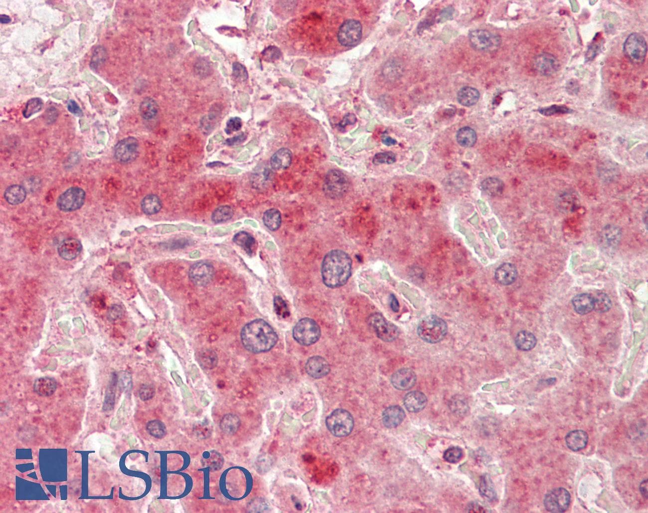 IHC-plus™ PRMT7 Antibody (aa327-340)