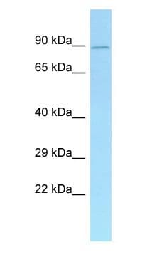 ADD1 / Adducin Alpha Antibody (N-Terminus)