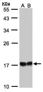 IHC-plus™ HSPB8 / H11 / HSP22 Antibody (aa134-196)