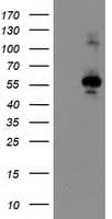 CCM2 / Malcavernin Antibody (clone OTI1E9)