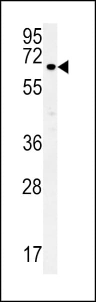 Polyclonal Rabbit anti-Human ESRP1 / RBM35A Antibody (aa182-211, IHC, WB)