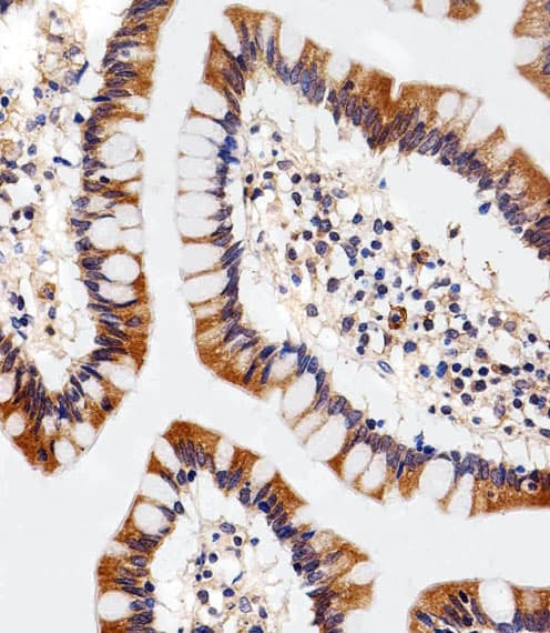 Polyclonal Rabbit anti-Human SLC29A1 / ENT1 Antibody (aa402-431, IHC, WB)