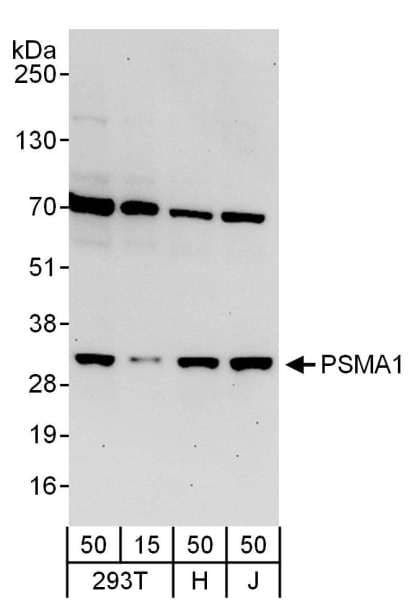 Polyclonal Rabbit anti-Human PSMA1 Antibody (aa213-263, IHC, WB)