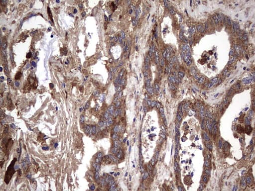 IL1RN Antibody (clone OTI2B1)