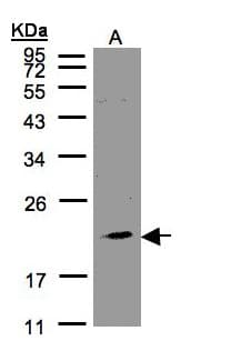 Polyclonal Rabbit anti-Human KLRC4 Antibody (aa1-45, WB)