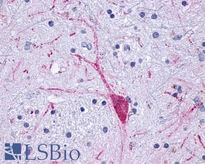 PathPlus™ OPRM1 / Mu Opioid Receptor Antibody (C-Terminus)