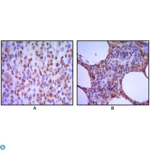 MUM1 Antibody