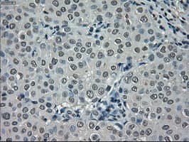 NEK6 Antibody (clone OTI2H7)