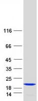 Human STMN1 / Stathmin / LAG Protein (Recombinant Myc-DDK (Flag))