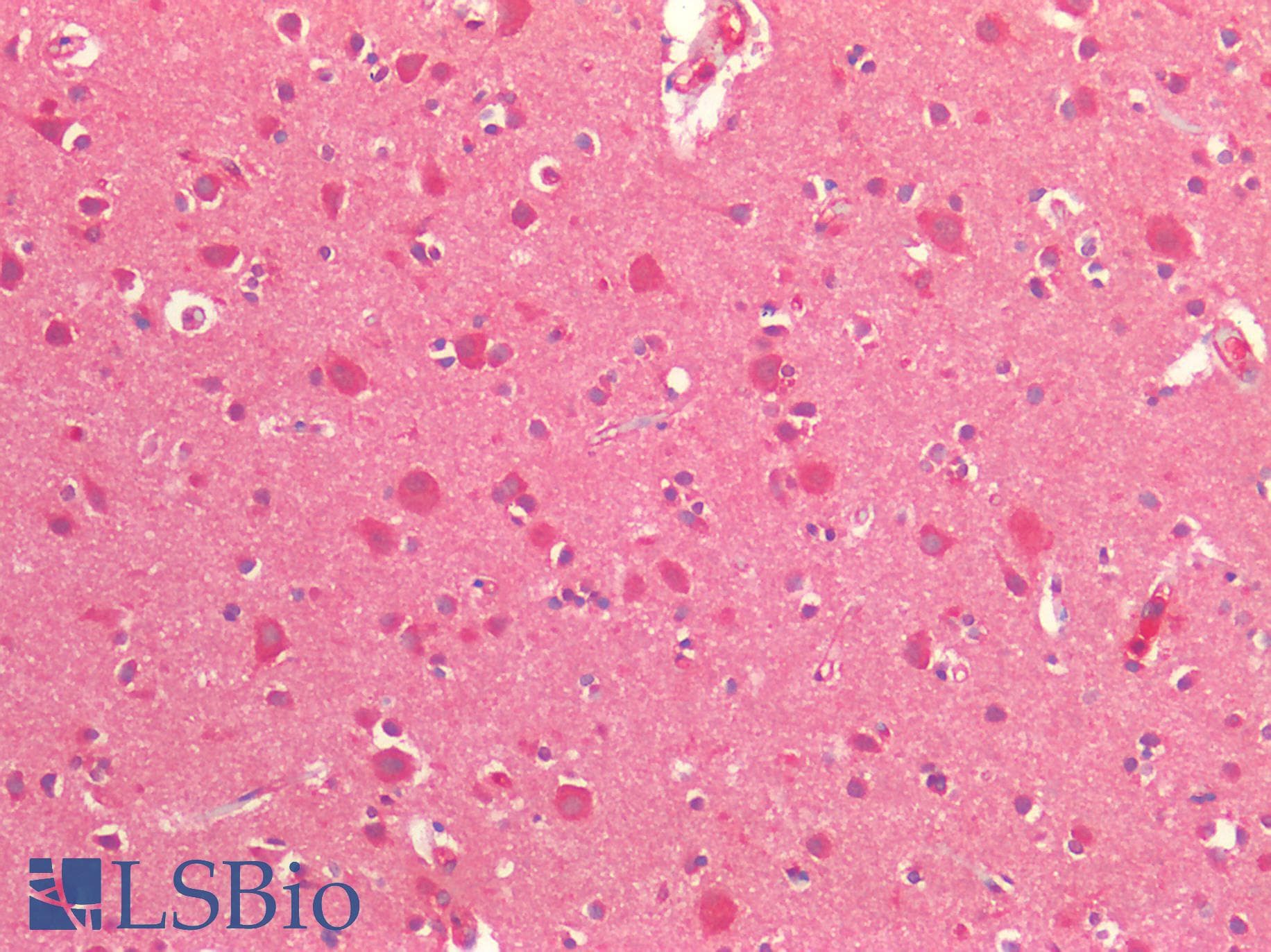 IHC-plus™ CYLD Antibody (clone 1667CT857.3.6.1)