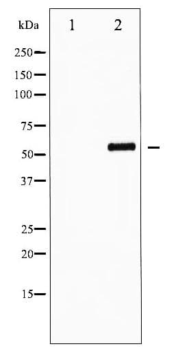 Polyclonal Rabbit anti-Human FOXO4 / AFX1 Antibody (phospho-Ser197, IHC, WB)