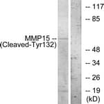 MMP15 Antibody (aa113-162)