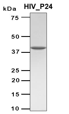 Human Immunodeficiency Virus 1 HIV-1 p24 Protein (Recombinant TRX-6His, N-terminus)