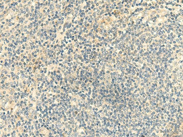Polyclonal Rabbit anti-Human CLEC10A / CD301 Antibody (IHC)