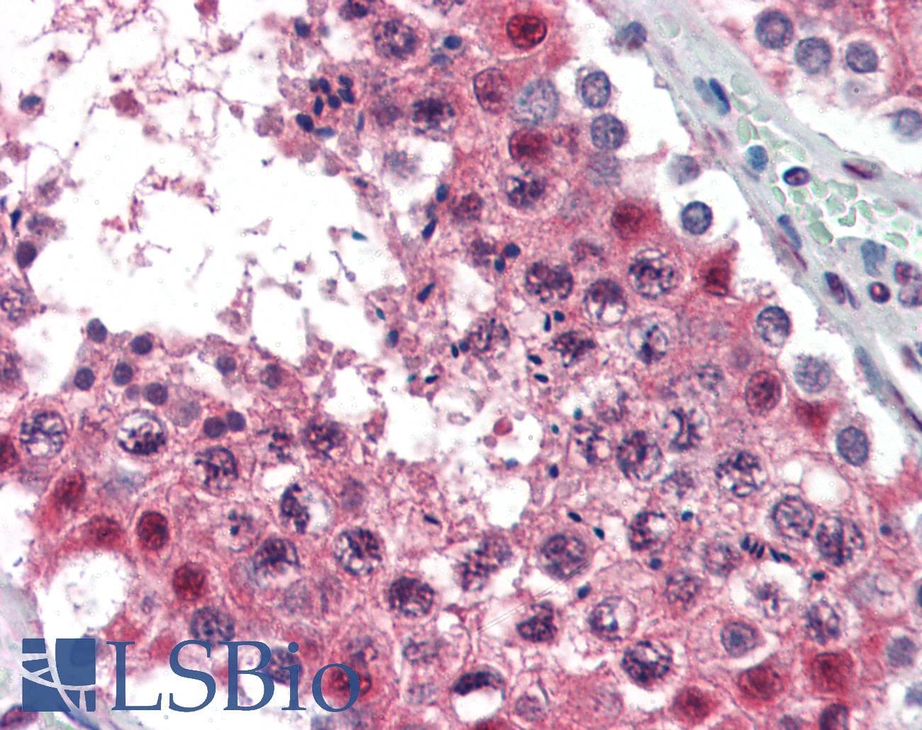 IHC-plus™ Monoclonal Mouse anti-Human MAT2A Antibody (clone AT3A2, aa1-395, IHC, WB)