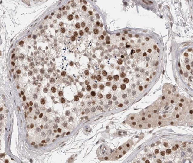 SRF / Serum Response Factor Antibody (phospho-Ser99)
