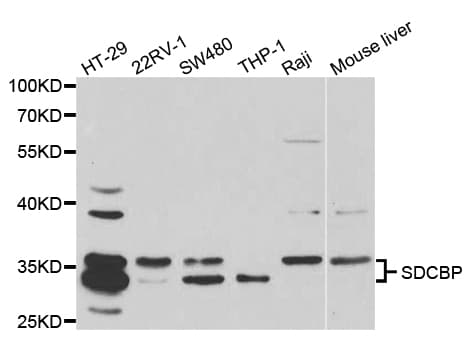 SDCBP / Syntenin Antibody