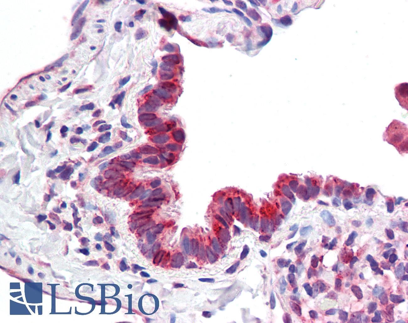 IHC-plus™ Polyclonal Goat anti-Human MICU1 / CBARA1 Antibody (aa113-126, IHC, WB)