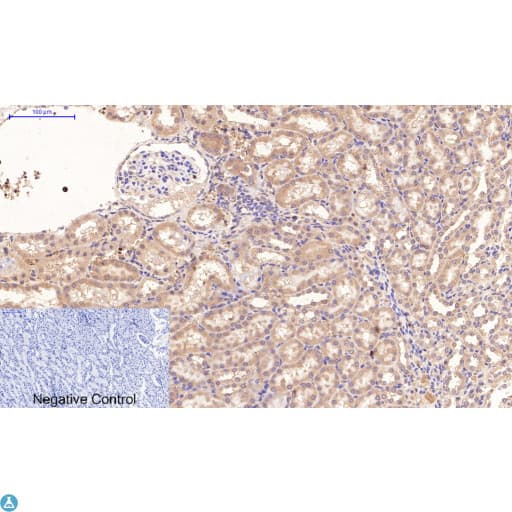 TUBE1 / Tubulin Epsilon Antibody