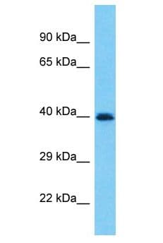 PRAMEF19 Antibody (aa74-123)