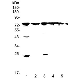 ADRBK1 / GRK2 Antibody