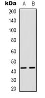 Polyclonal Rabbit anti-Human MAPKAPK3 Antibody (C-Terminus, IHC, IF, WB)