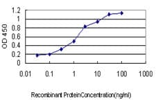 Monoclonal Mouse anti-Human GRAP2 / GRID Antibody (clone 1G12, IHC, WB)