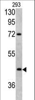LRG1 / LRG Antibody (aa194-223)