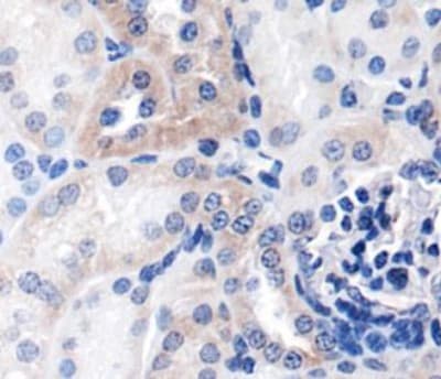NFKB1 / NF-Kappa-B Antibody