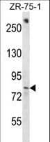Polyclonal Rabbit anti-Human BACH1 Antibody (aa670-698, WB)