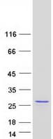 Human LYG2 Protein (Recombinant Myc-DDK (Flag))