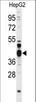 FEN1 Antibody (aa243-272)
