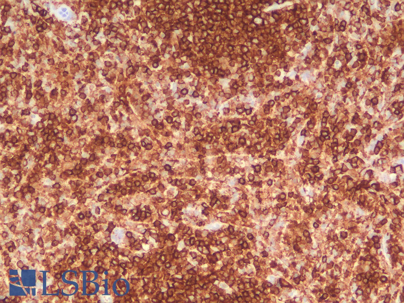 PathPlus™ CD45 / LCA Antibody (clone PTPRC/1783R)