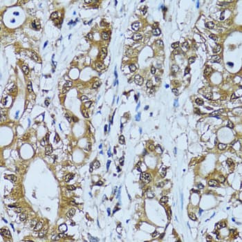 Polyclonal Rabbit anti-Human NOL3 / ARC Antibody (IHC, IF, WB)