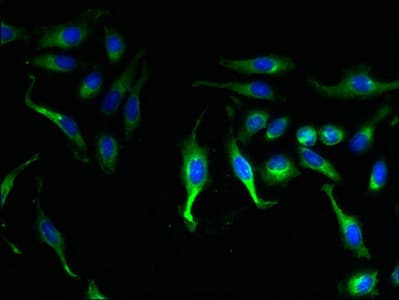 KCNMB1 Antibody