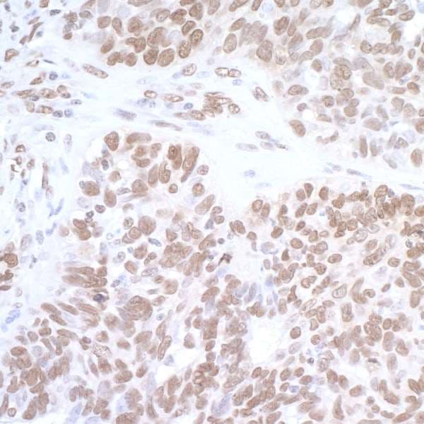 Polyclonal Rabbit anti-Human FUS / TLS Antibody (aa400-450, IHC, WB)
