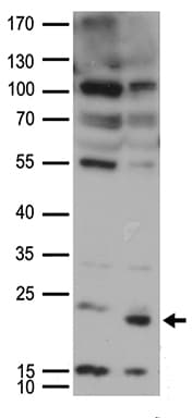 UBE2I / UBC9 Antibody