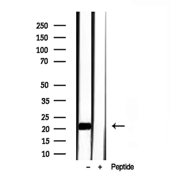 TAGLN2 / Transgelin 2 Antibody