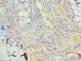 TDG / Thymine DNA Glycosylase Antibody (aa141-410)