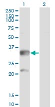 CBR3 Antibody (clone 1G8)