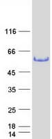 Human TFG Protein (Recombinant Myc-DDK (Flag))
