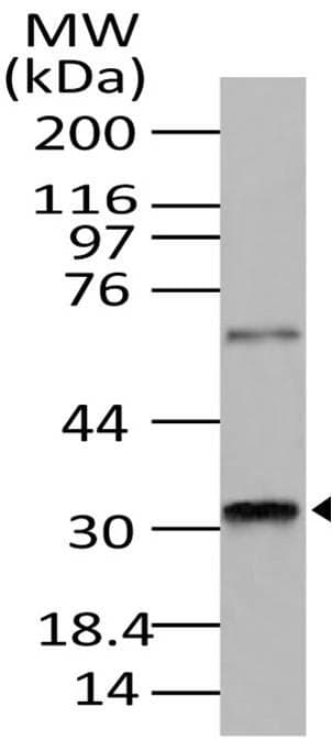 PRKRA / PACT Antibody (aa100-313)